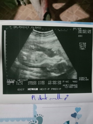 คลอดเดือน ส.ค