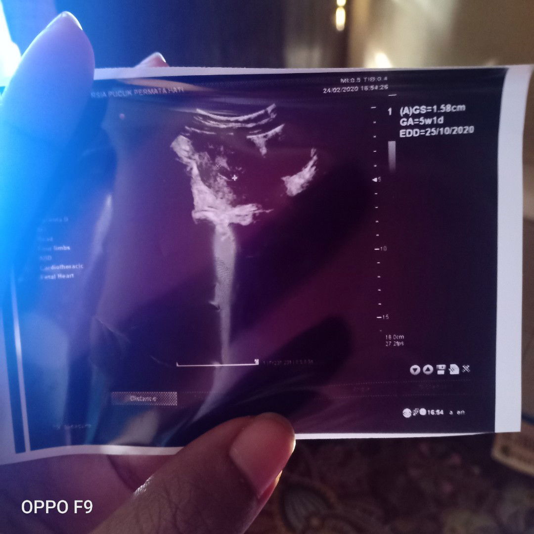 Berbagi pengalaman ...