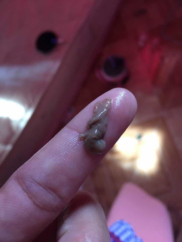 มูกหรือมาดขาว36+5w