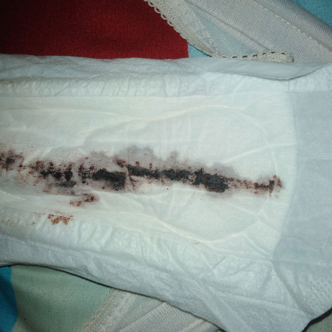 Tanya2 Seputar Kehamilan Muda