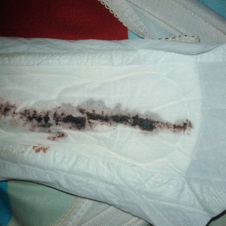 Tanya2 Seputar Kehamilan Muda