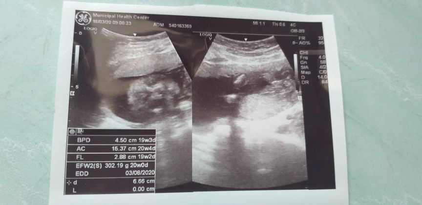 ขอเสียงแม่ๆไปซาวมาแล้วอดรู้เพศน้องหน่อยค่ะ