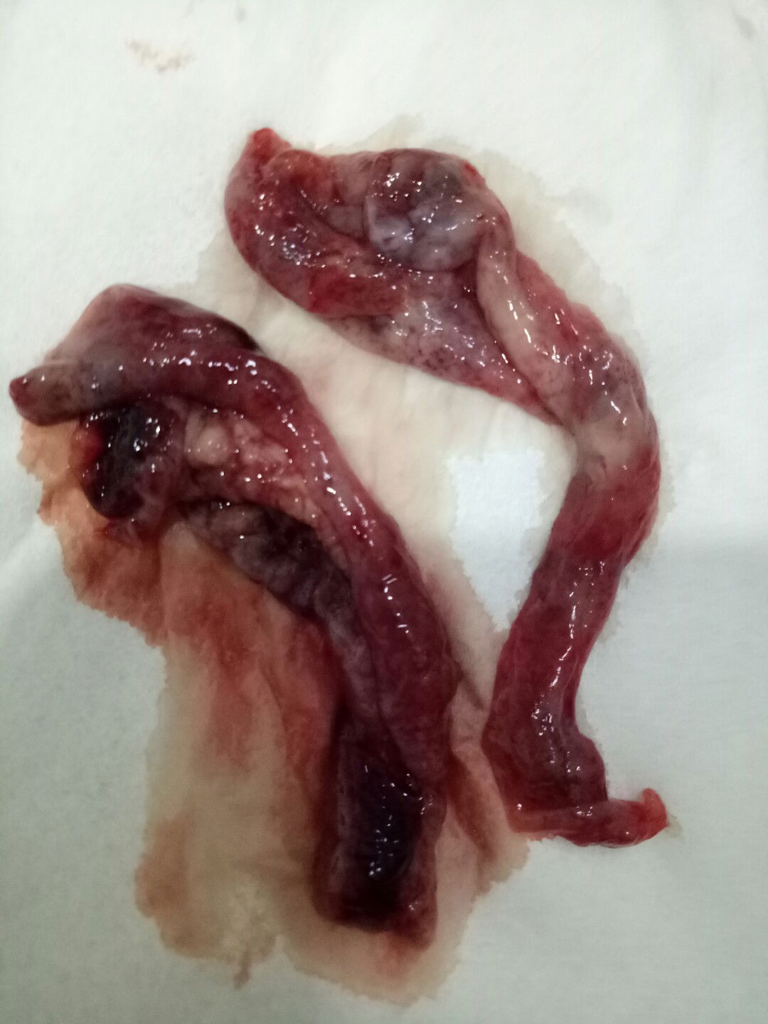 keguguran di minggu ke 5