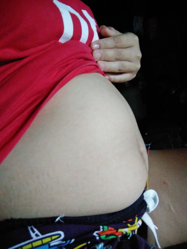 ท้องเล็ก
