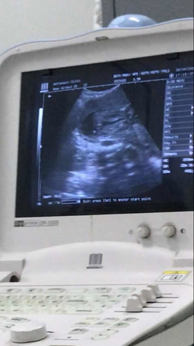 22w แล้วค่ะ