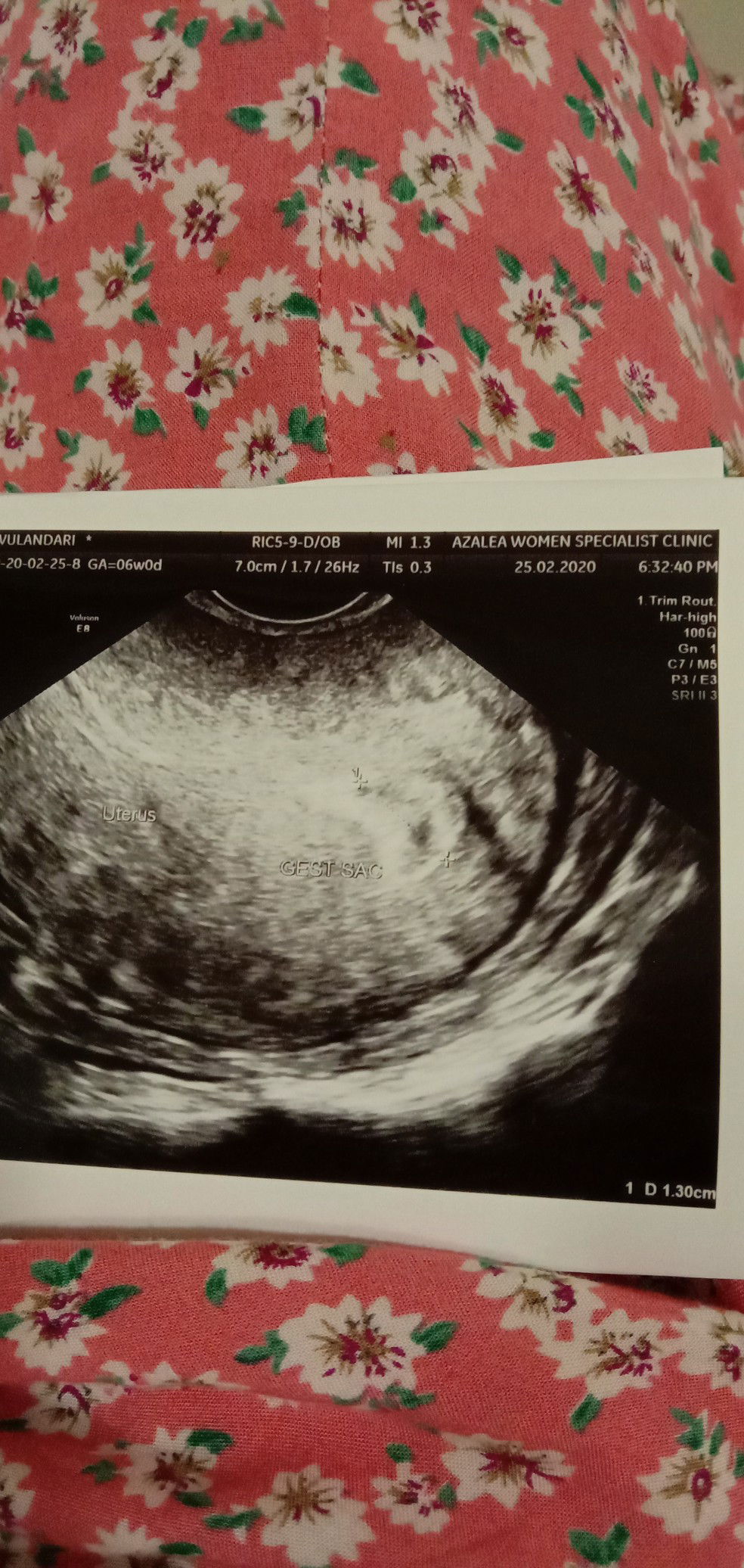 pregn 6 week bleding sudah 14 hari