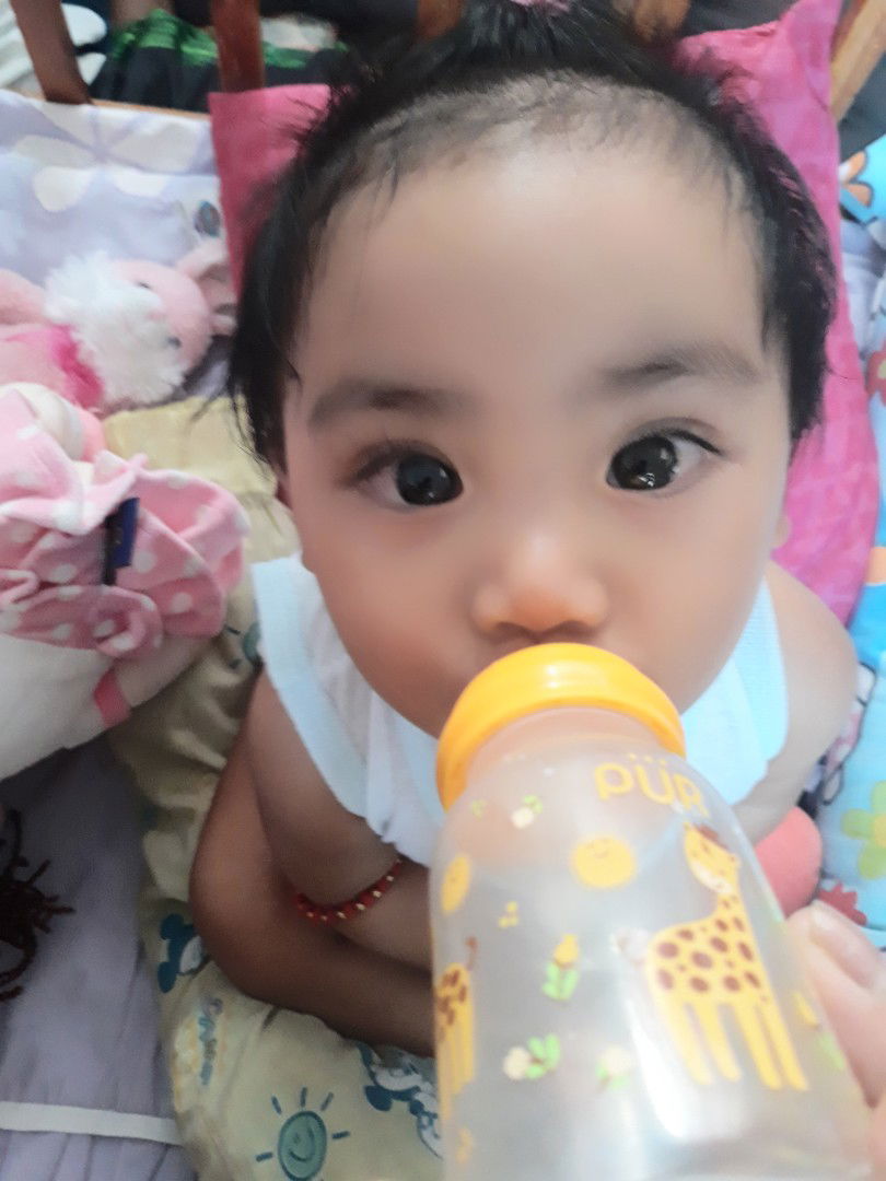 Baby's having eye redness?