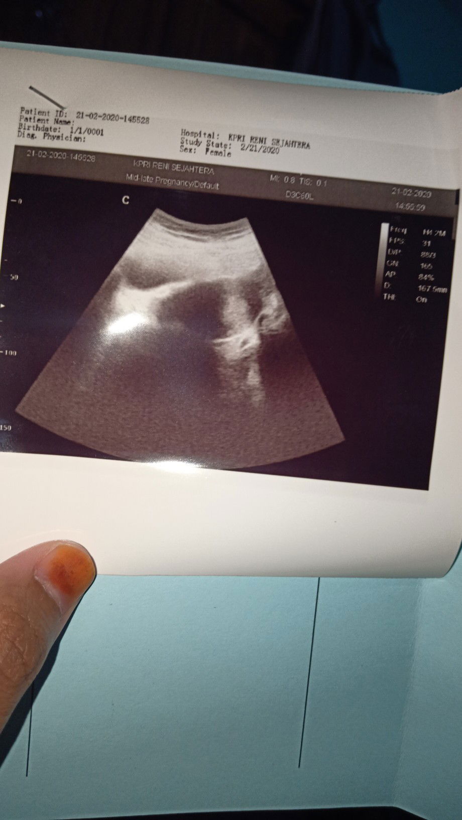 seputar kehamilan