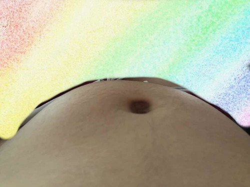 มดลูกลอยหรือลูกโก่งตัว