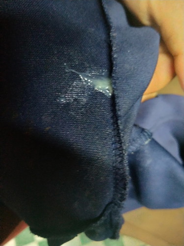 ใช่มูกหรือตกขาวค่ะ37+3 สัปดาห์ค่ะ