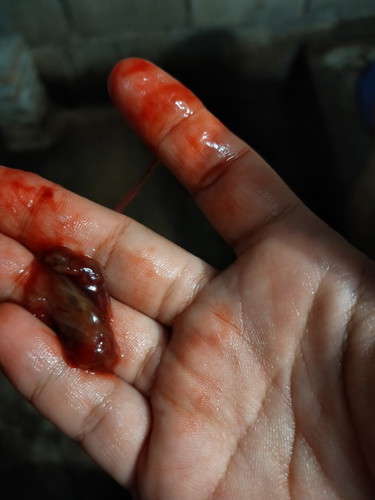 มีเหมือนเลือดๆใช่น้ำคาวปลาไหมคะ