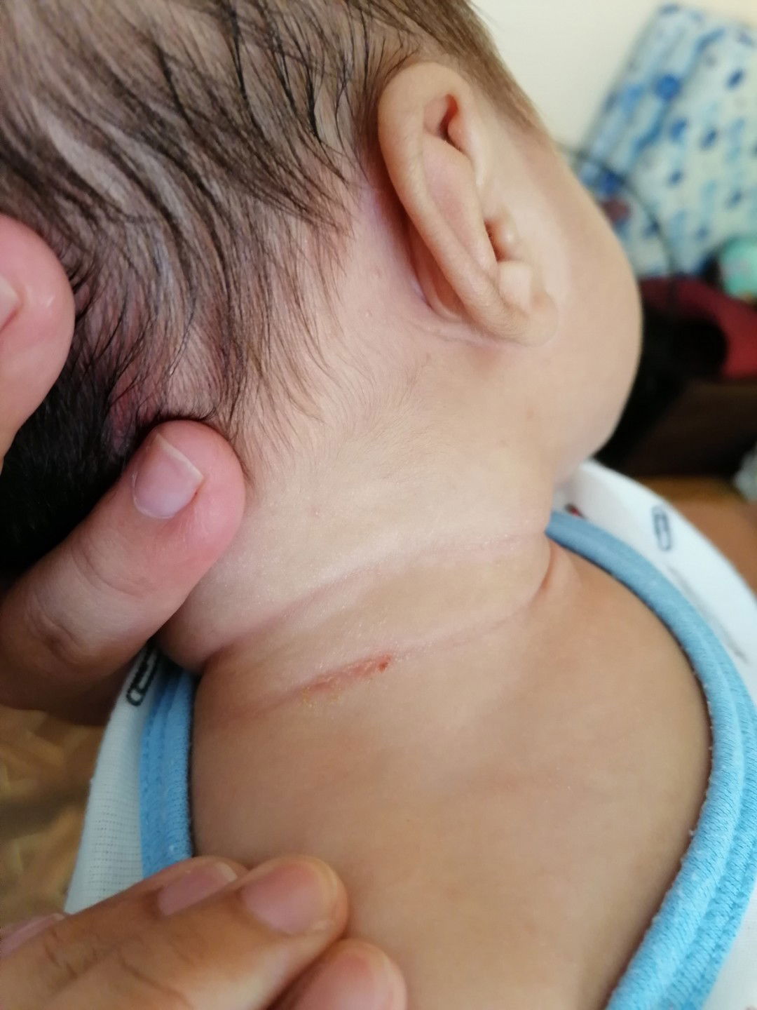 Eczacort Effective Ba?