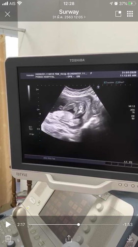 ช่วยดูให้หน่อยนะ ว่าเป็น ผู้หญิงหรือผู้ชาย อาค่ะ