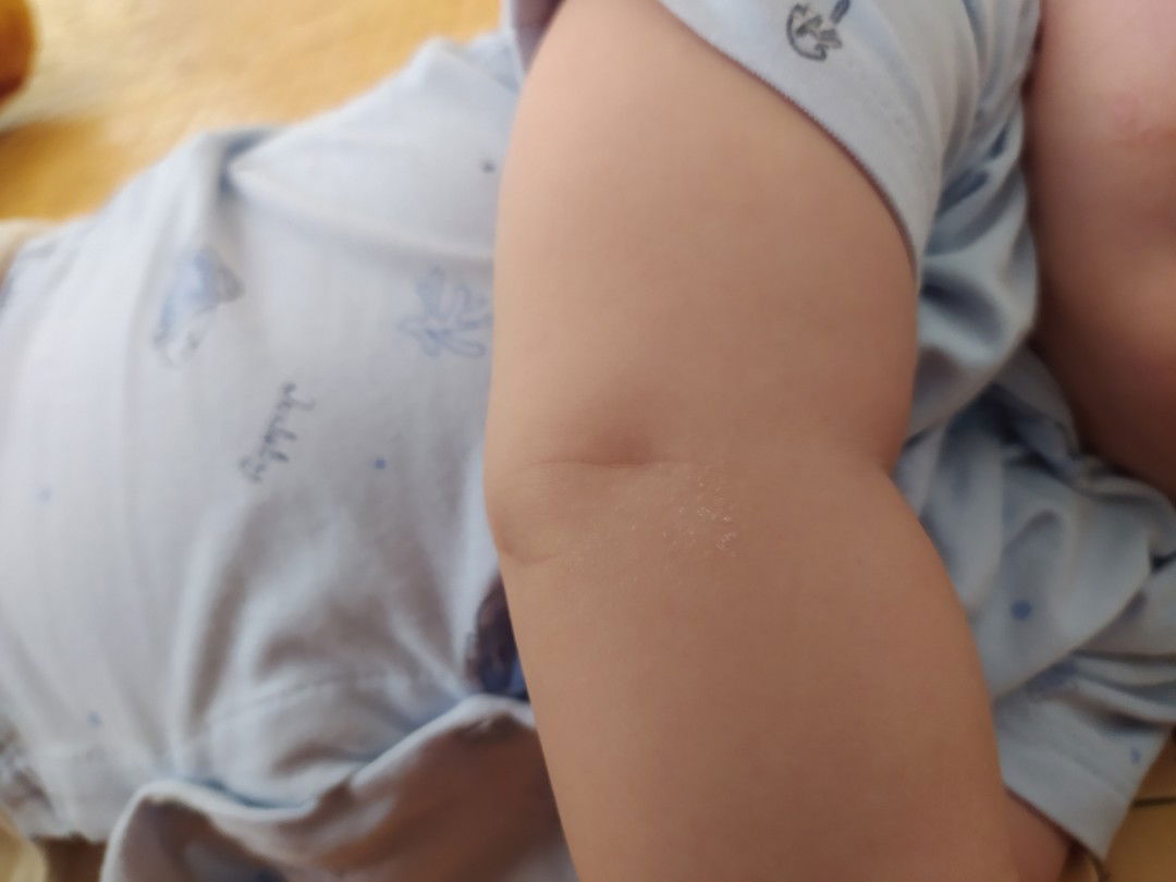 hỏi bệnh da liễu bé 5m