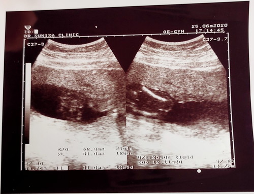 แม่ดูใบซาวน์ไม่ออกค่ะ ส่วนไหนเป็นส่วนไหน