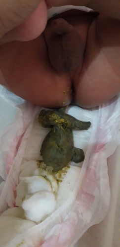 baby ppoooops ng 3months old