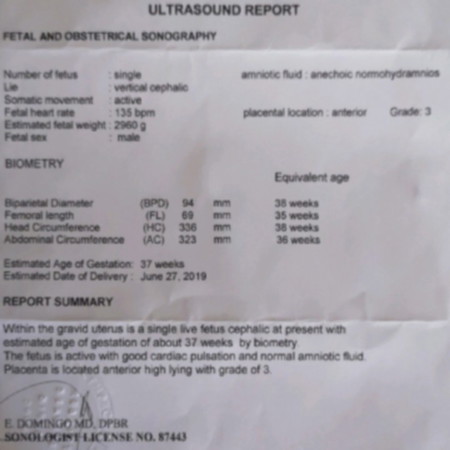 Ultrasound Result