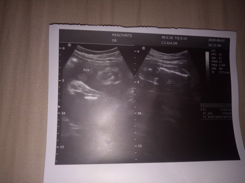 My ultrasound