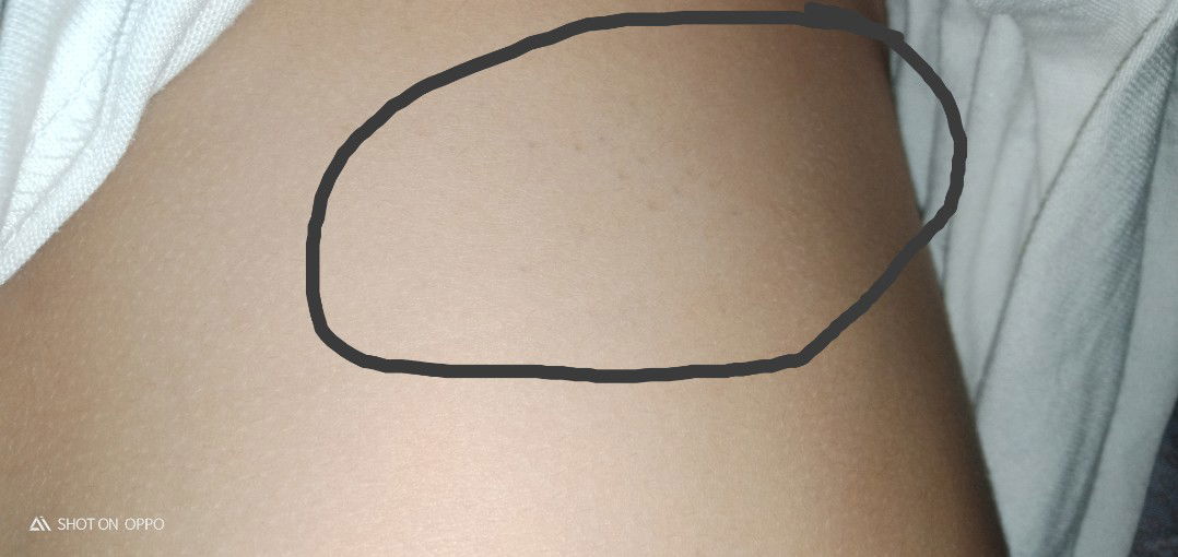 Skin observation that's odd