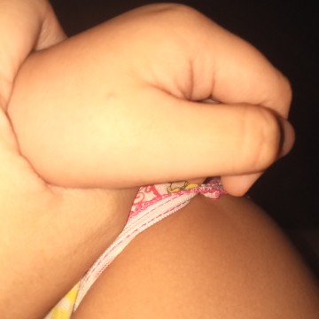 skin disease