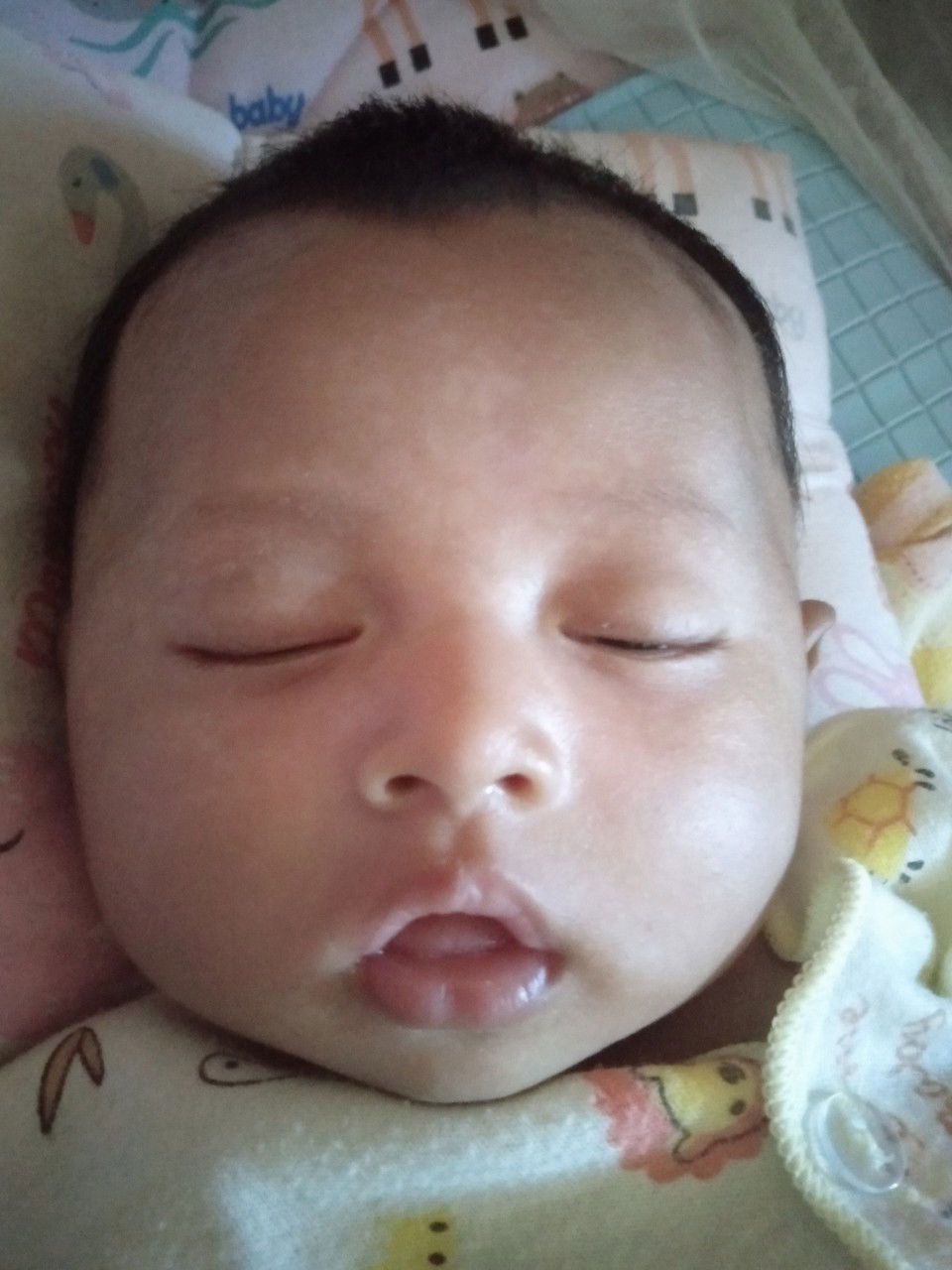 putih-putih di area muka