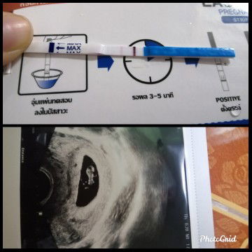 วรารัตน์ ขัตติยะ profile icon