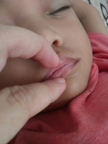 bibir putih putih