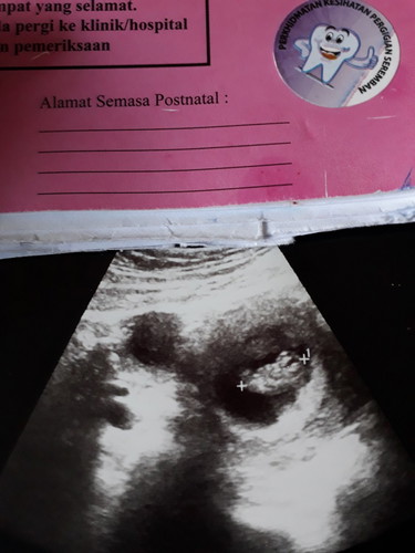 yg mana placenta