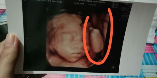 ??