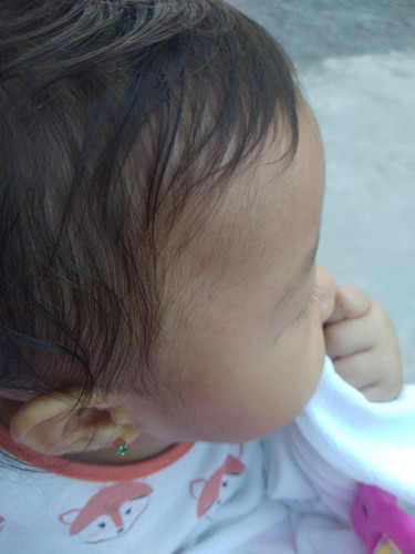 singaw lang ba ng init?