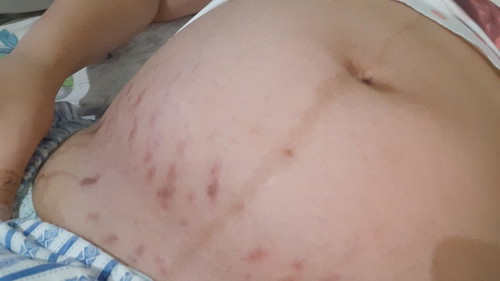 Normal lang kaya ito?6mns preggy