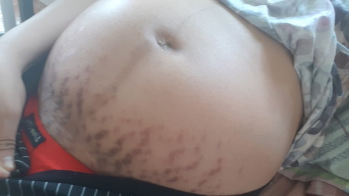 30weeks & 5days