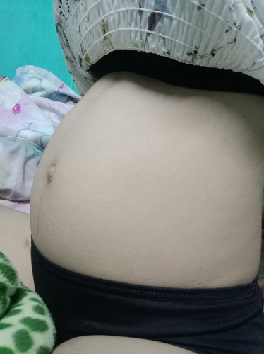 ท้องเล็กมั้ย?