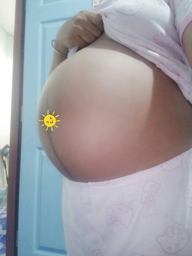 แม่ๆว่าท้องลงต่ำหรือยังคะ 35w+5ท้องแข็งบ่อยมากเลยคะช่วงนี้
