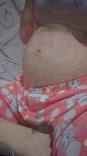 ตั้งครรภ์