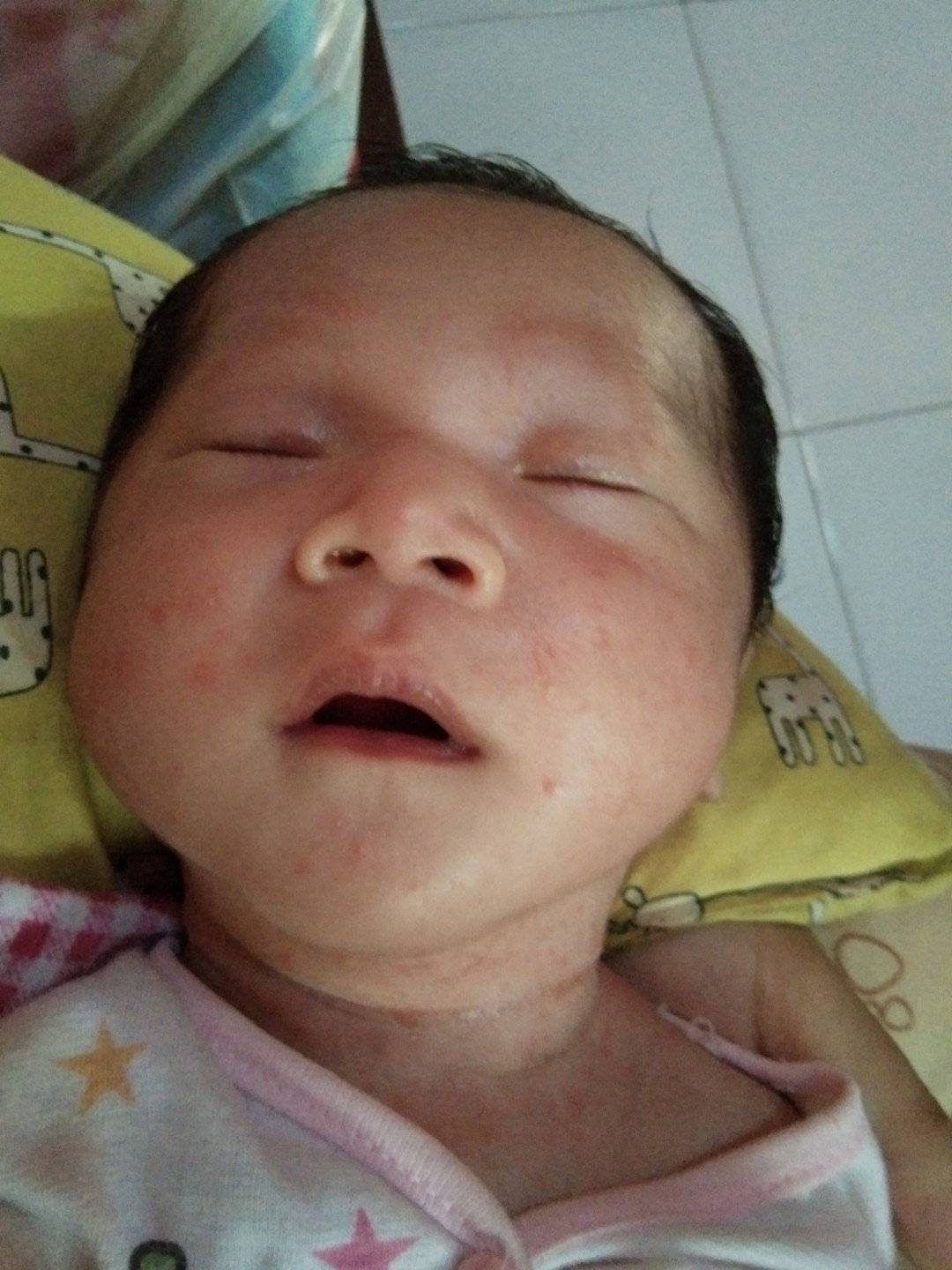 bintik merah
