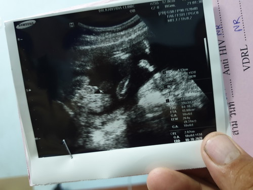 แม่ๆ ช่วยดูหน่อยค่ะ ผญ หรือ ผช คะ 18w 5d