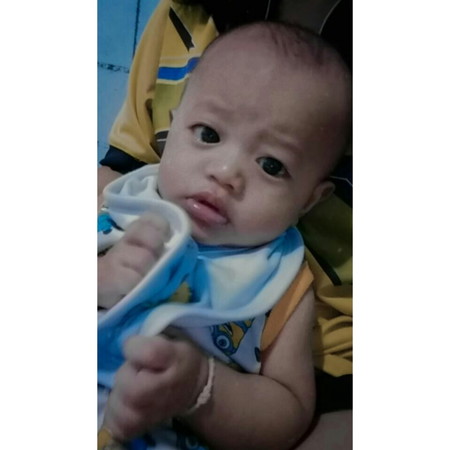 วิธีลดน้ำหมูก
