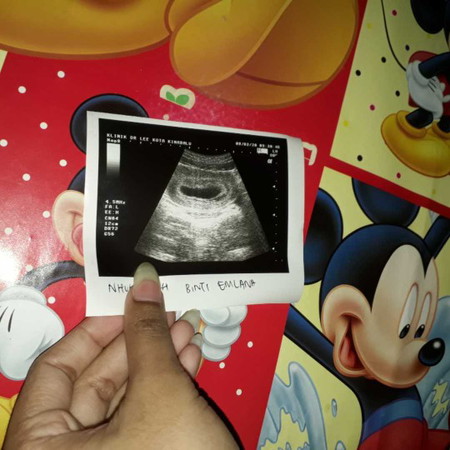 9wk fist time pi klnik