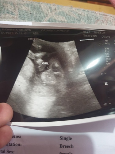 its baby girll??