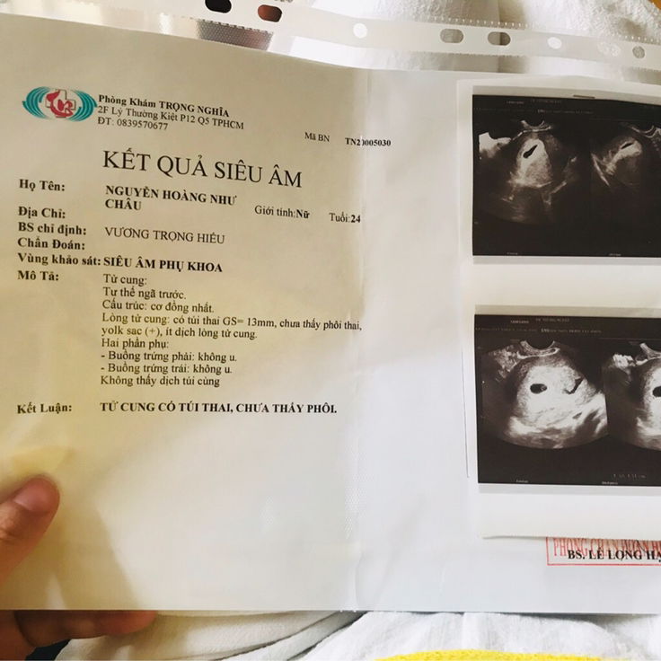 Lần đầu mang thai