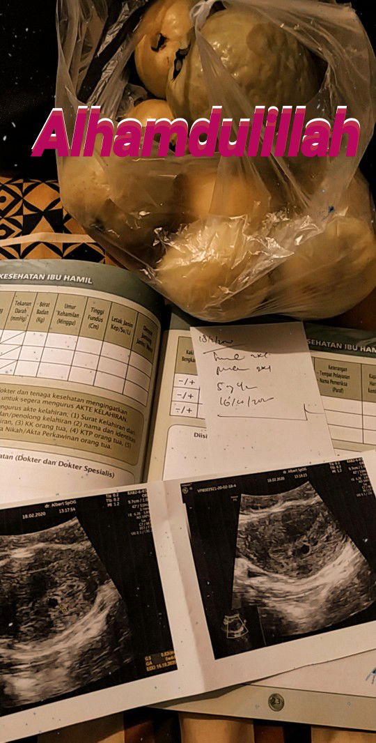 Shafira Anditiningrum profile icon