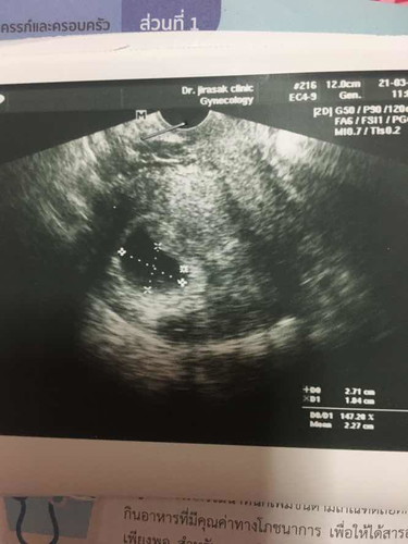 แม่ๆเห็นน้องตอนอายุครรภ์เท่าไร 8-9สัปดาห์แล้วยังไม่เห็นน้องเลย