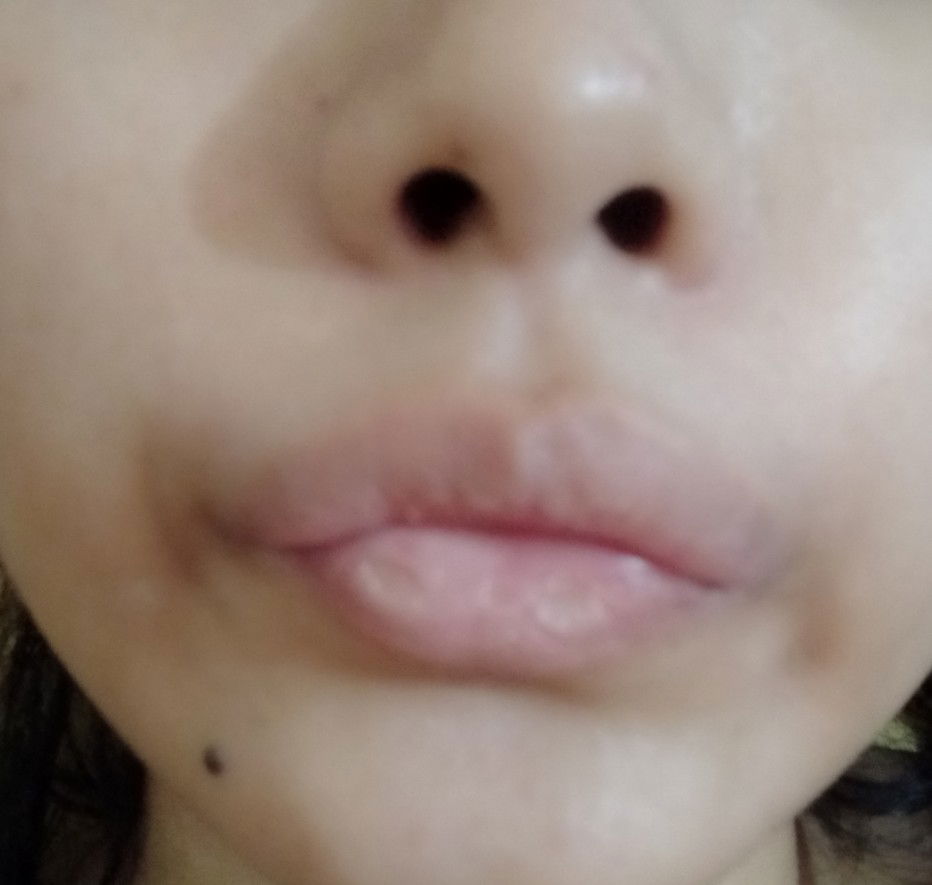bibir ku kering
