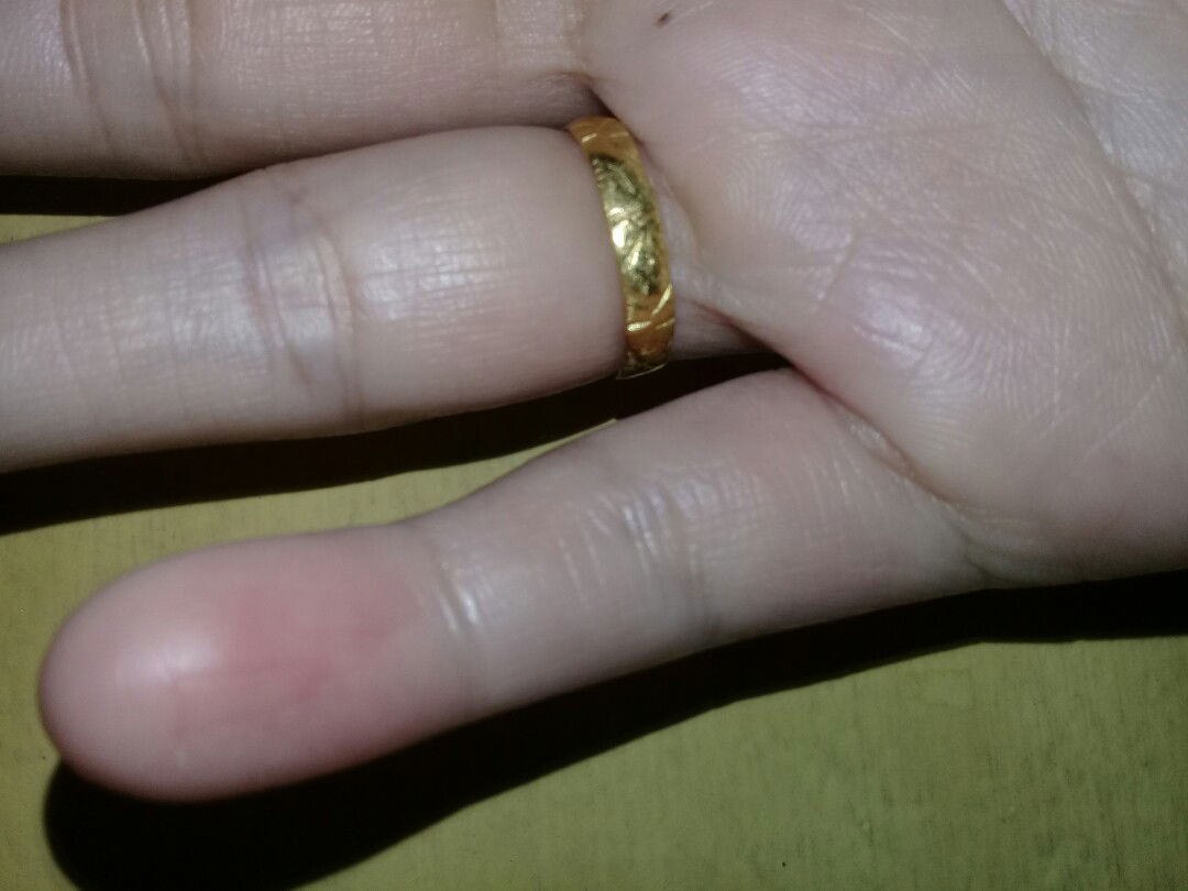 jari kelingking perih