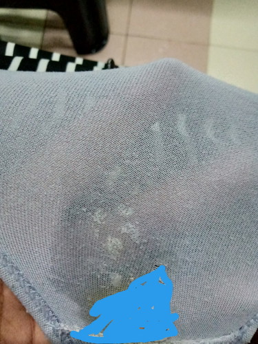 ตกขาวหรือน้ำคร่ำรั่ว