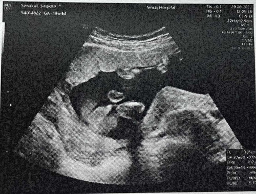 แม่ๆช่วยตั้งชื่อให้หน่อยค่ะ