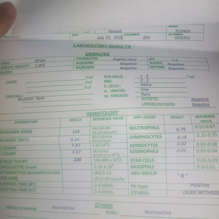urinalysis