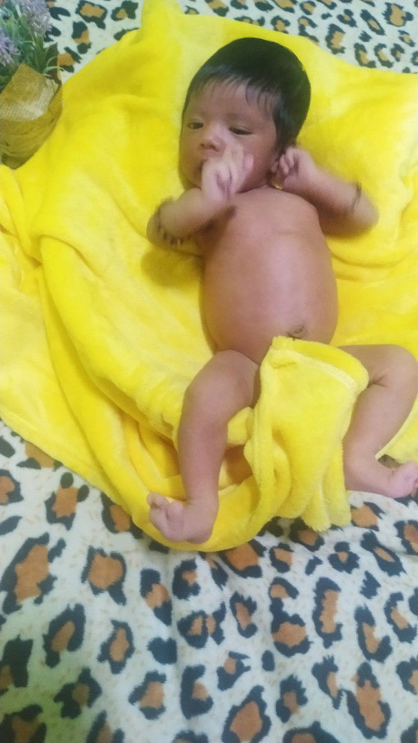 perut bayi terlihat besar dan keras , apakah ini normal untuk bayi usia 35 hari ?