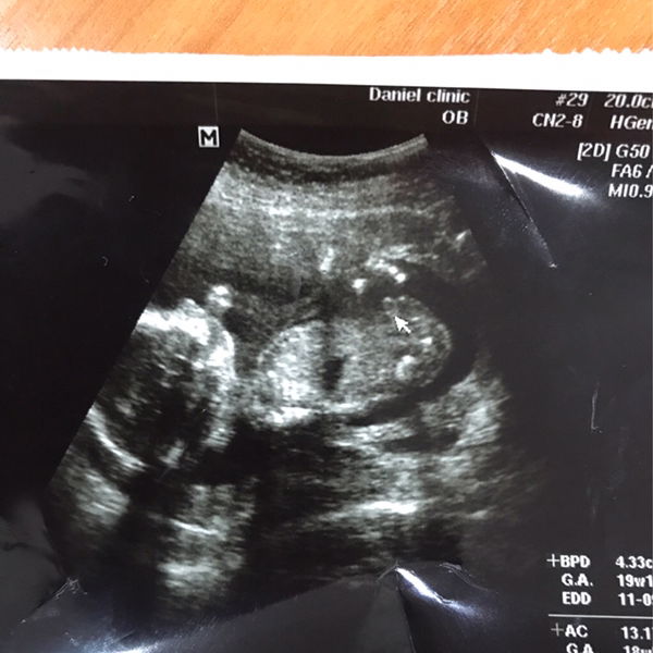 Areya wann profile icon